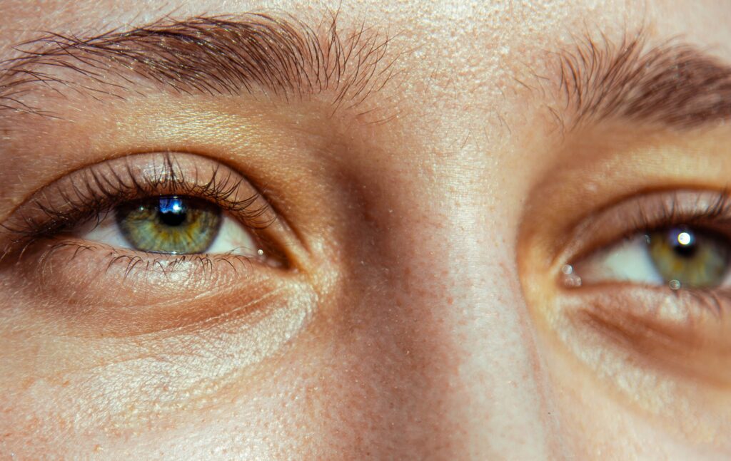 puffy eyes